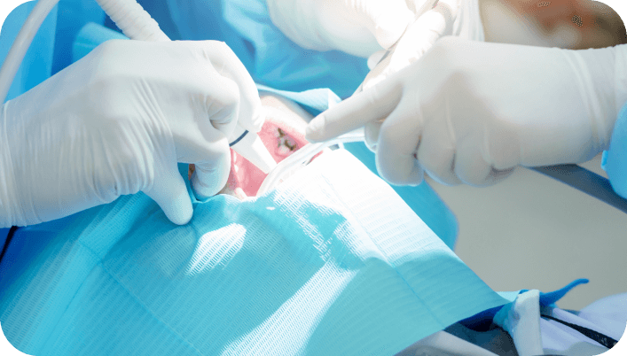 Surgical Periodontal Treatment