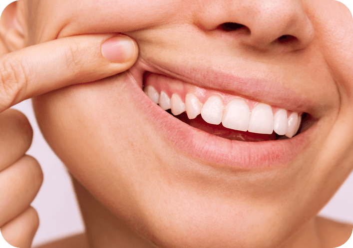 What is Periodontal Disease?