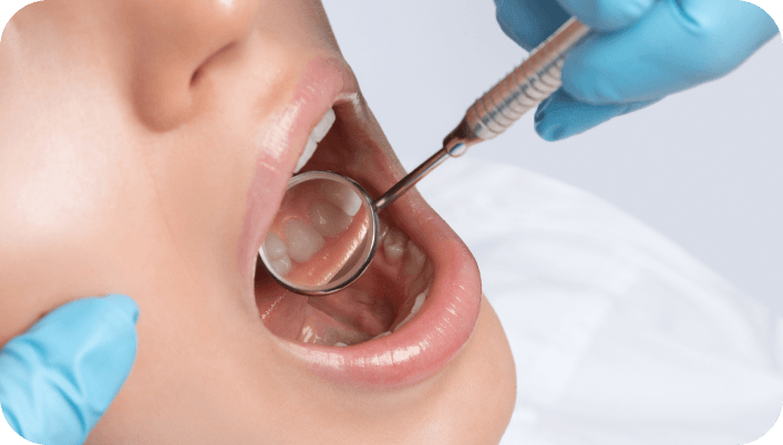 Non-surgical Periodontal Treatment